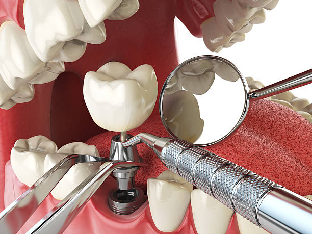Best Emergency Dentist for Knocked-Out Tooth in Pelion, SC